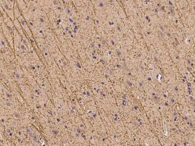 Immunohistochemistry-Paraffin: ZFHX2 Antibody [NBP2-98080] - Immunochemical staining of human ZFHX2 in human brain with rabbit polyclonal antibody at 1:100 dilution, formalin-fixed paraffin embedded sections.