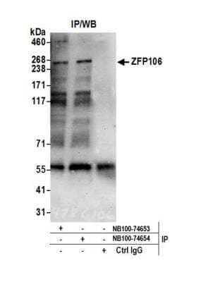 Immunoprecipitation: ZFP106 Antibody [NB100-74653] - Detection of human ZFP106 by western blot of immunoprecipitates. Samples: Nuclear Extract (0.5 or 1.0 mg per IP reaction; 20% of IP loaded) from HEK293T cells. Antibodies: Affinity purified rabbit anti-ZFP106 antibody NB100-74653 used for IP at 6 ug per reaction. ZFP106 was also immunoprecipitated by rabbit anti-ZFP106 antibody NB100-74654. For blotting immunoprecipitated ZFP106, NB100-74653 was used at 1 ug/ml. Detection: Chemiluminescence with an exposure time of 75 seconds.