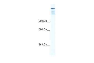 Western Blot: ZFP106 Antibody [NBP2-88616] - WB Suggested Anti-ZFP106 Antibody Titration: 0.125ug/ml. ELISA Titer: 1:62500. Positive Control: Human muscle