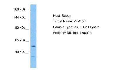 Western Blot: ZFP106 Antibody [NBP2-88617] - Host: Rabbit. Target Name: ZFP106. Sample Tissue: Human 786-0 Whole Cell lysates. Antibody Dilution: 1ug/ml