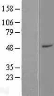 Western Blot ZFP2 Overexpression Lysate