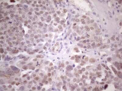 Immunohistochemistry ZFP200 Antibody (OTI5F4)