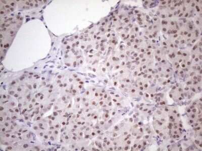 Immunohistochemistry ZFP200 Antibody (OTI5F4)