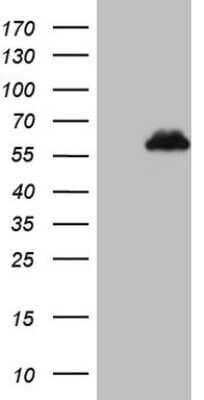 Western Blot: ZFP200 Antibody (OTI5F4) - Azide and BSA Free [NBP2-74923] - Analysis of HEK293T cells were transfected with the pCMV6-ENTRY control (Left lane) or pCMV6-ENTRY ZNF200.