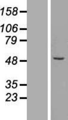 Western Blot: ZFP200 Overexpression Lysate (Adult Normal) [NBL1-18081] Left-Empty vector transfected control cell lysate (HEK293 cell lysate); Right -Over-expression Lysate for ZFP200.