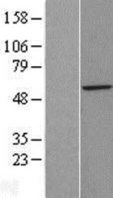 Western Blot: ZFP200 Overexpression Lysate (Adult Normal) [NBL1-18082] Left-Empty vector transfected control cell lysate (HEK293 cell lysate); Right -Over-expression Lysate for ZFP200.