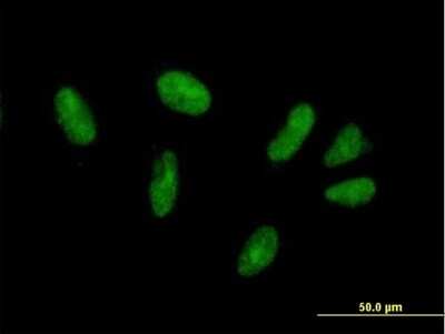 Immunocytochemistry/Immunofluorescence: ZFP28 Antibody [H00140612-B01P] - Analysis of purified antibody to ZFP28 on HepG2 cell. (antibody concentration 10 ug/ml)