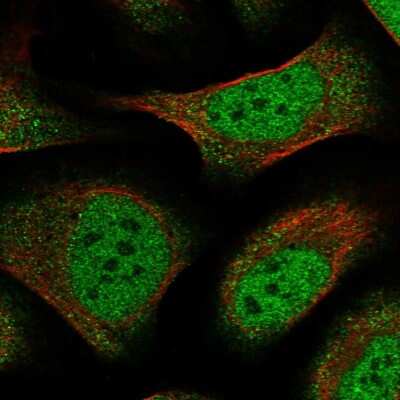 Immunocytochemistry/ Immunofluorescence ZFP28 Antibody - BSA Free