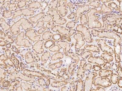 Immunohistochemistry: ZFP28 Antibody [NBP3-06636] - Immunochemical staining of human ZFP28 in human kidney with NBP3-06636 at 1:500 dilution, formalin-fixed paraffin embedded sections.