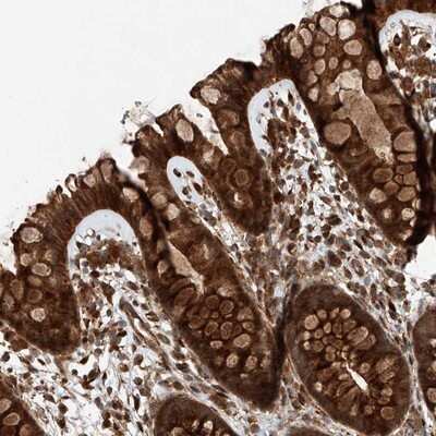 Immunohistochemistry-Paraffin ZFP28 Antibody - BSA Free
