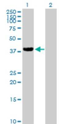 Western Blot: ZFP28 Antibody [H00140612-B01P] - Analysis of ZFP28 expression in transfected 293T cell line by ZFP28 polyclonal antibody.  Lane 1: ZFP28 transfected lysate(38.39 KDa). Lane 2: Non-transfected lysate.
