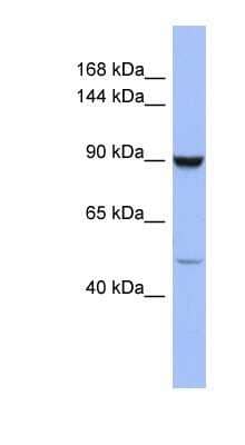 Western Blot: ZFP28 Antibody [NBP1-80348] - Titration: 0.2-1 ug/ml, Positive Control: COLO205 cell lysate.