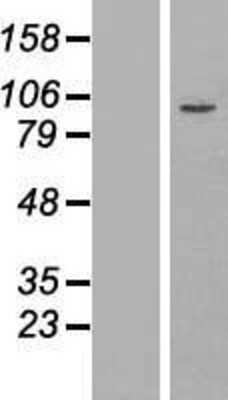 Western Blot: ZFP28 Overexpression Lysate (Adult Normal) [NBP2-06604] Left-Empty vector transfected control cell lysate (HEK293 cell lysate); Right -Over-expression Lysate for ZFP28.