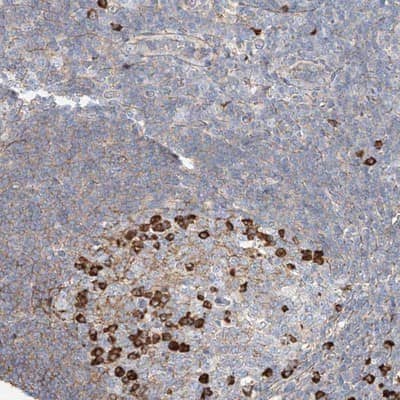 Immunohistochemistry-Paraffin: ZFP30 Antibody [NBP1-81455] - Staining of human tonsil shows strong cytoplasmic positivity in subsets of reaction center cells.
