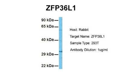 Western Blot: ZFP36L1 Antibody [NBP2-86903] - Host: Rabbit. Target Name: ZFP36L1. Sample Tissue: Human 293T. Antibody Dilution: 1.0ug/ml