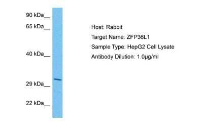 Western Blot: ZFP36L1 Antibody [NBP2-86903] - Host: Rabbit. Target Name: ZFP36L1. Sample Tissue: Human HepG2 Whole Cell. Antibody Dilution: 1ug/ml