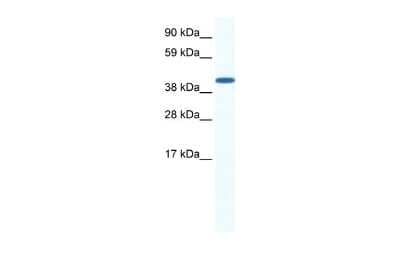 Western Blot: ZFP36L1 Antibody [NBP2-86905] - WB Suggested Anti-ZFP36L1 Antibody Titration: 0.2-1 ug/ml. ELISA Titer: 1:62500. Positive Control: Human Placenta