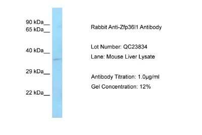 Western Blot: ZFP36L1 Antibody [NBP2-86907] - Host: Rabbit. Target Name: Zfp36I1. Sample Type: Mouse Liver. Antibody Dilution: 1.0ug/ml