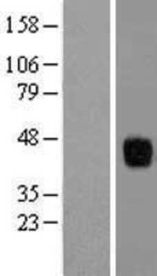 Western Blot: ZFP36L1 Overexpression Lysate (Adult Normal) [NBL1-18019] Left-Empty vector transfected control cell lysate (HEK293 cell lysate); Right -Over-expression Lysate for ZFP36L1.