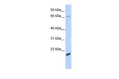 Western Blot: ZFP37 Antibody [NBP2-86415] - WB Suggested Anti-ZFP37 Antibody Titration: 0.2-1 ug/ml. ELISA Titer: 1:312500. Positive Control: 721_B cell lysateZFP37 is supported by BioGPS gene expression data to be expressed in 721_B