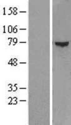 Western Blot: ZFP37 Overexpression Lysate (Adult Normal) [NBL1-18020] Left-Empty vector transfected control cell lysate (HEK293 cell lysate); Right -Over-expression Lysate for ZFP37.