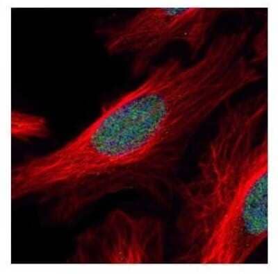 Immunocytochemistry/Immunofluorescence: ZFP38 Antibody [NBP2-20944] - Confocal immunofluorescence analysis of paraformaldehyde-fixed HeLa, using ZNF38 antibody (Green) at 1:500 dilution. Alpha-tubulin filaments are labeled with Alpha-tubulin antibody (Red) at 1:2000.