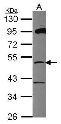 Western Blot: ZFP38 Antibody [NBP2-20944] - Sample (30 ug of whole cell lysate) A: Hela 10% SDS PAGE gel, diluted at 1:1000.