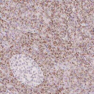 Immunohistochemistry-Paraffin: ZFP41 Antibody [NBP2-31633] - Staining of human pancreas shows strong cytoplasmic positivity, with a granular pattern in exocrine glandular cells.