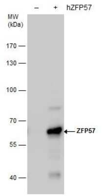 Western Blot: ZFP57 Antibody (4512) [NBP2-43812] - Analysis of Non-transfected (-) and ZFP57 -transfected (+, including 3xFlag-tag) 293T whole cell extracts (30 ug) were separated by 7.5% SDS-PAGE, and the membrane was blotted with ZFP57 antibody diluted by 1:5000.