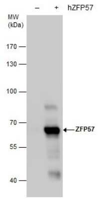 Western Blot: ZFP57 Antibody (865) [NBP2-43813] - Analysis of Non-transfected (-) and ZFP57 -transfected (+, including 3xFlag-tag) 293T whole cell extracts (30 ug) were separated by 7.5% SDS-PAGE, and the membrane was blotted with ZFP57 antibody diluted by 1:5000.