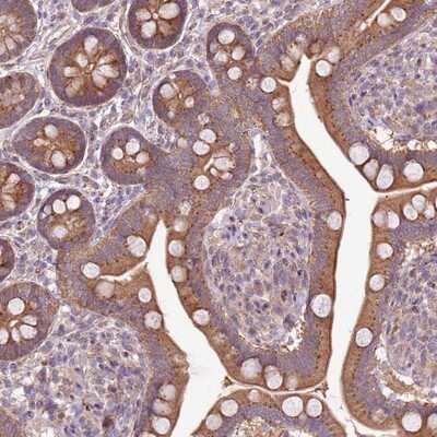 Immunohistochemistry-Paraffin: ZFP57 Antibody [NBP1-94138] Staining of human small intestine shows moderate cytoplasmic positivity in glandular cells.