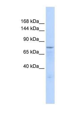 Western Blot: ZFP62 Antibody [NBP1-91531] - 293T cells lysate, concentration 0.2-1 ug/ml.