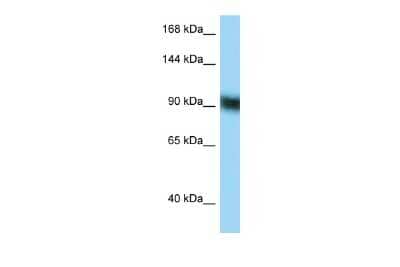 Western Blot: ZFP62 Antibody [NBP2-86416] - WB Suggested Anti-ZFP62 Antibody. Titration: 1.0 ug/ml. Positive Control: RPMI-8226 Whole Cell