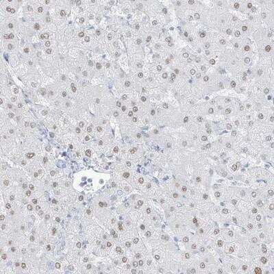 Immunohistochemistry-Paraffin: ZFP64 Antibody [NBP1-85171] - Staining of human liver shows nuclear positivity in hepatocytes.