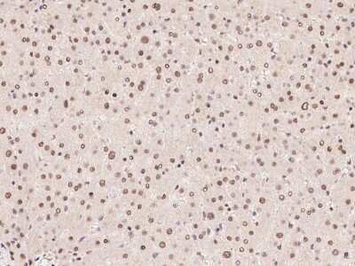 Immunohistochemistry-Paraffin: ZFP64 Antibody [NBP2-97565] - Immunochemical staining of human ZFP64 in human liver with rabbit polyclonal antibody at 1:100 dilution, formalin-fixed paraffin embedded sections.