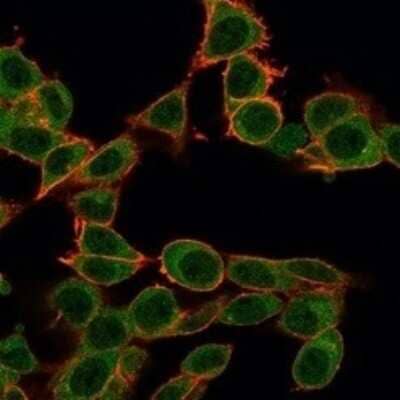 Immunocytochemistry/Immunofluorescence: ZFP64 Antibody (PCRP-ZFP64-1H2) [NBP3-08648] - Immunofluorescence Analysis of PFA-fixed HeLa cells using ZFP64 Mouse Monoclonal Antibody (PCRP-ZFP64-1H2) followed by goat anti- Mouse IgG-CF488 (green). CF640A phalloidin (red).