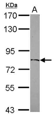 Western Blot: ZFP64 Antibody [NBP2-20946] - Sample (30 ug of whole cell lysate) A: IMR32 7. 5% SDS PAGE gel, diluted at 1:1000.