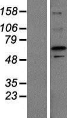 Western Blot: ZFP64 Overexpression Lysate (Adult Normal) [NBP2-04613] Left-Empty vector transfected control cell lysate (HEK293 cell lysate); Right -Over-expression Lysate for ZFP64.