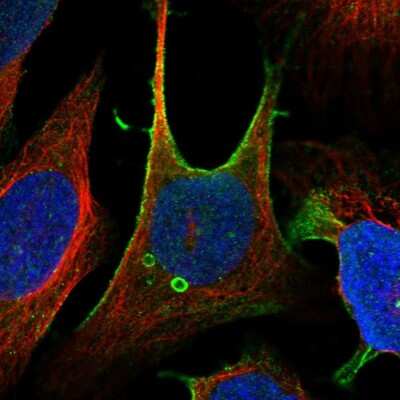 Immunocytochemistry/Immunofluorescence: ZFP90 Antibody [NBP1-81355] - Immunofluorescent staining of human cell line U-2 OS shows localization to plasma membrane, centrosome & vesicles.