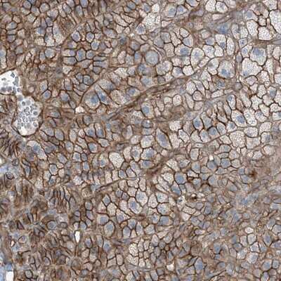 Immunohistochemistry-Paraffin: ZFP90 Antibody [NBP1-81355] - Staining of human adrenal gland shows strong membranous positivity in cortical cells.