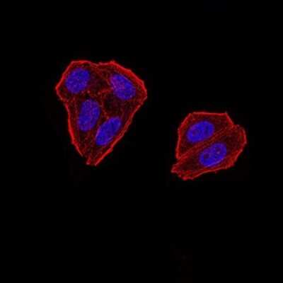 Immunocytochemistry/Immunofluorescence: ZFP91 Antibody (7G11H2) [NBP2-61854] - Analysis of Hela cells using ZFP91 mouse mAb. Blue: DRAQ5 fluorescent DNA dye. Red: Actin filaments have been labeled with Alexa Fluor- 555 phalloidin.