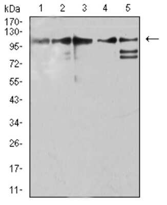 Western Blot: ZFP91 Antibody (7G11H2) [NBP2-61854] - Analysis using ZFP91 mouse mAb against Jurkat (1), A431 (2), HepG2 (3), HEK293 (4), and A549 (5) cell lysate.