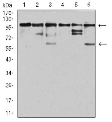 Western Blot: ZFP91 Antibody (8C3D5) [NBP2-61847] - Analysis using ZFP91 mouse mAb against Jurkat (1), A431 (2), HepG2 (3), HEK293 (4), A549 (5), and PC-3 (6) cell lysate.