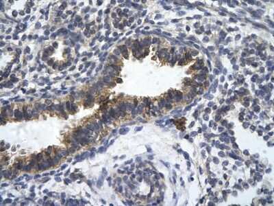 Immunohistochemistry-Paraffin ZFR Antibody - BSA Free