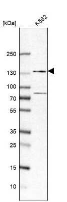 Western Blot ZFR Antibody - BSA Free