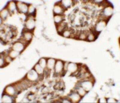 Immunohistochemistry ZFX Antibody - BSA Free