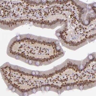 Immunohistochemistry-Paraffin: ZFX Antibody [NBP1-80583] - Human duodenum shows moderate nuclear positivity in glandular cells.