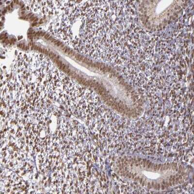 Immunohistochemistry-Paraffin: ZFX Antibody [NBP1-80583] - Staining of human endometrium shows moderate nuclear positivity in glandular cells.