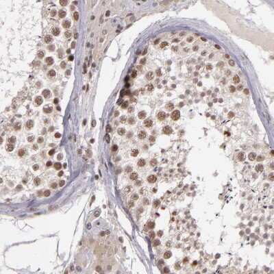 Immunohistochemistry-Paraffin: ZFX Antibody [NBP1-80583] - Staining of human testis shows weak to moderate nuclear positivity in cells in seminiferous ducts.