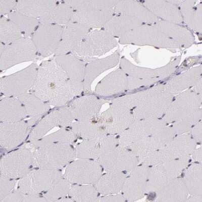 Immunohistochemistry-Paraffin: ZFX Antibody [NBP1-80583] - Staining of human skeletal muscle shows no positivity in myocytes as expected.